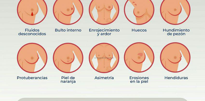 cancer de mama