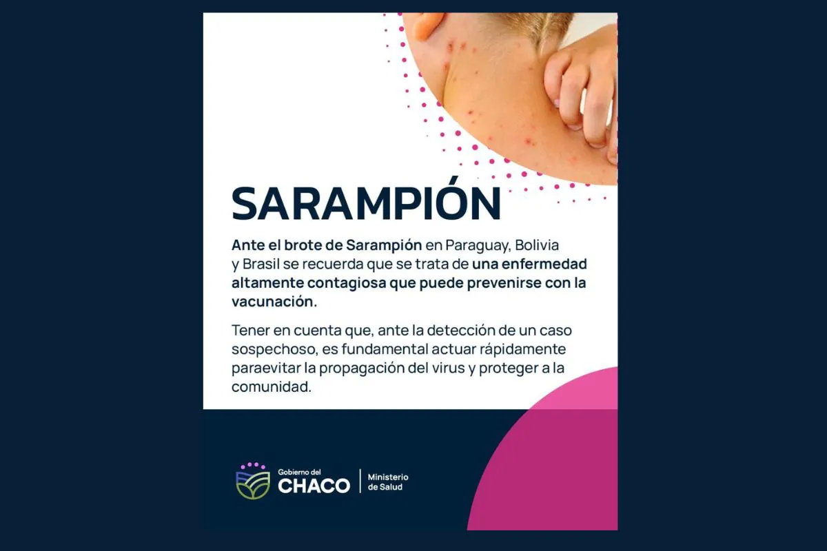 Sarampion